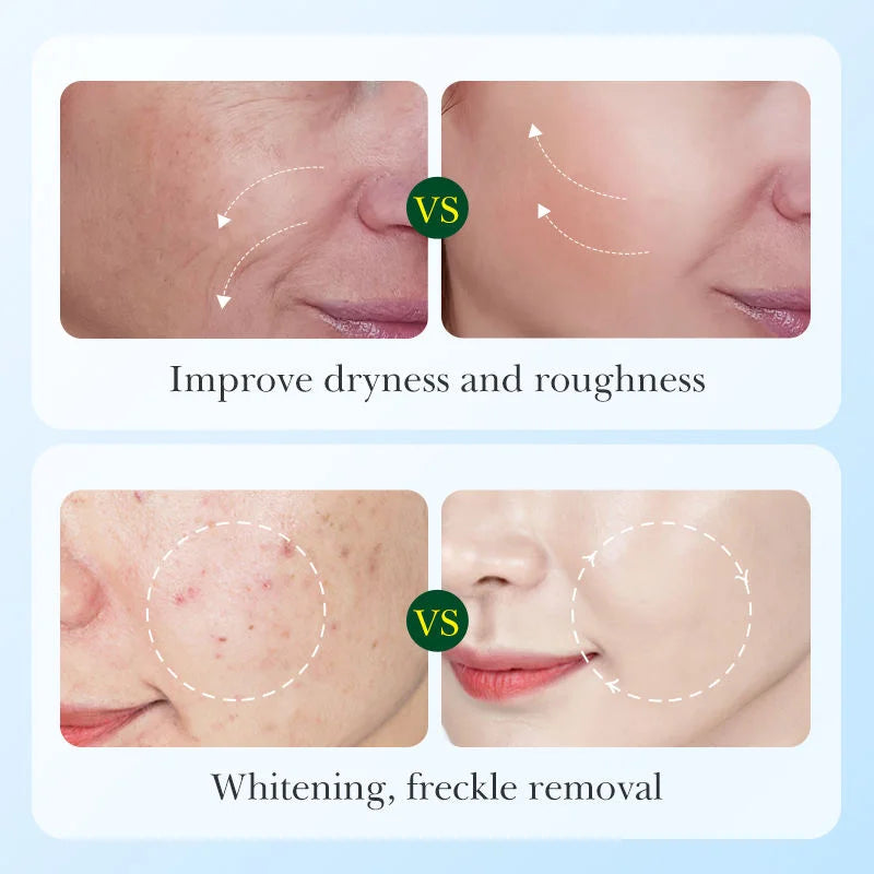 Sadoer - Licorice Root Whitening Skin Care Set (Original) - 6 in 1